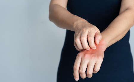 Itching of skin diseases in women using the hand-scratching. Red around the Itching area. Concept with Healthcare And Medicine.の写真素材