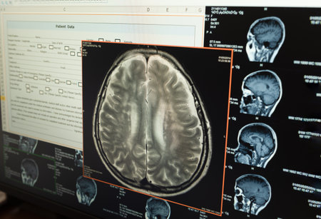 brain image on screen computer from CT scan or MRI scan. healthcare and medicine concept.の写真素材