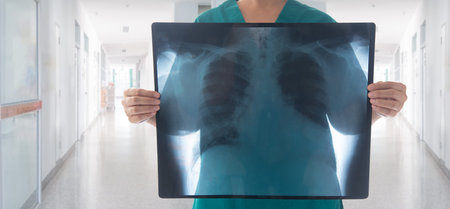 doctor holding chest x-ray film of patient at hospital ward.