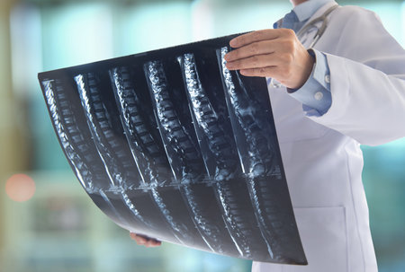 doctor surgeon look at spine x-ray film of patient at operating room.の写真素材
