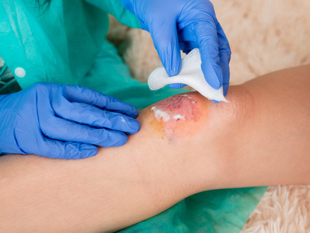 The doctor's gloved hands are working on an abrasion on the knee of the patient's girlfriend,...