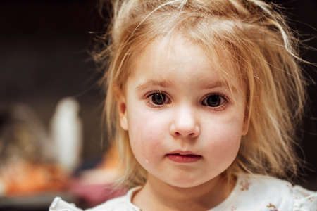 Portrait of little cute caucasial child crying in frustration. Red dark eyes, blond hair. So cute and sweet kids mood.の写真素材