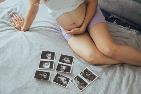 Young pregnant caucasian woman, future mother, sitting on comfortable bed and looking at ultrasound x ray photos of her baby in tummy, view from the top.の写真素材