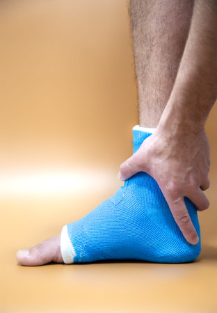 Blue splint ankle. Bandaged leg cast on male patient on colored blurred background. Sports injury concept.の写真素材