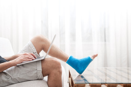 Man with a broken leg in blue splint for treatment of injurie and ankle sprain is using a laptop at home.の写真素材