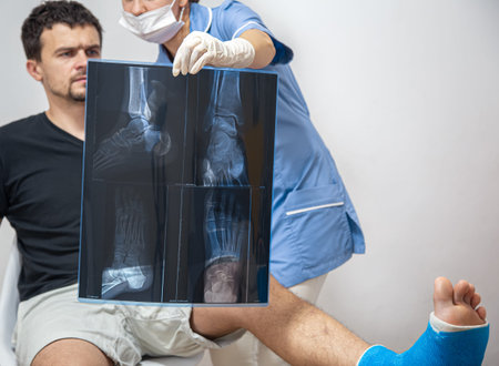 Female doctor in a blue medical gown explains to a male patient with a broken leg the result of an...
