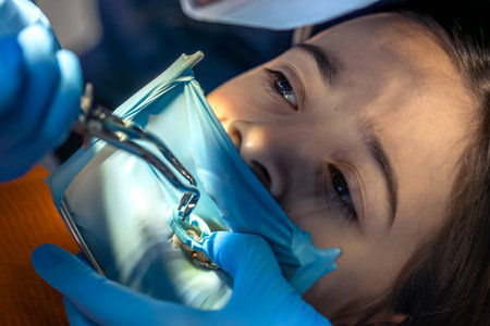 The dentist treats the childs tooth using a rubber dam. Close-up of tooth treatment.