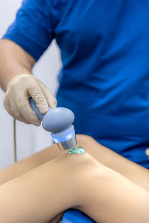 Physiotherapist performs ultrasound therapy on female patient knee. Joint rehabilitation.
