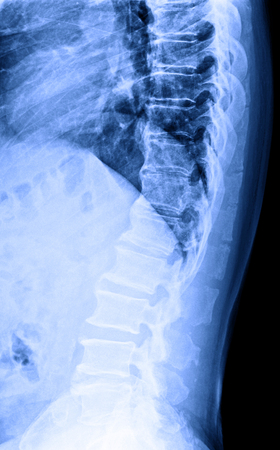 X-Ray image of male human lumbar spine (L-S spine) for medical diagnosis. Lateral view.