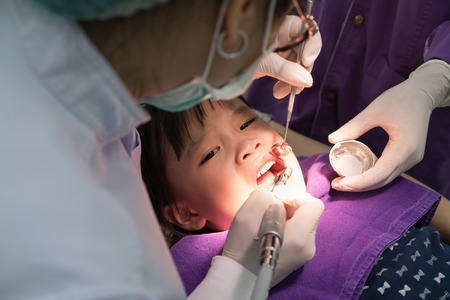 close-up medical dentist procedure of teeth polishing with cleaning from dental deposit and odontolith. Dentist polishing asian girls teeth.の写真素材