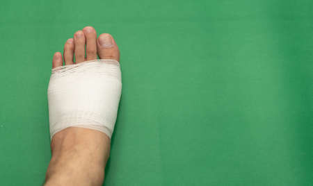 gauze bandage at foot for medic treatmentの写真素材