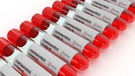 Covid-19 test. Corona virus infection. Positive test result by using rapid test device for COVID-19. 3D. 3D renderingの写真素材