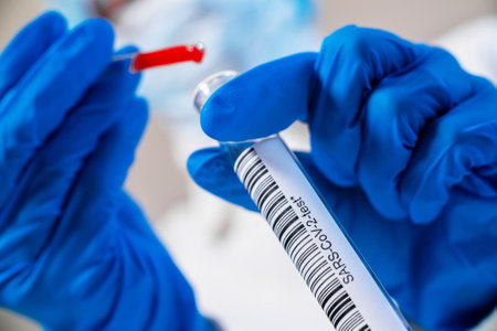 Test tube with SARS-CoV-2 in the hands, coronavirus COVID-19