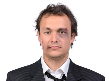 Portrait of a businessman fighting with bruises on her face, isolated on white backgroundの写真素材