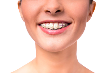 Portrait of a beautiful woman with braces on teeth, isolated on a white backgroundの写真素材