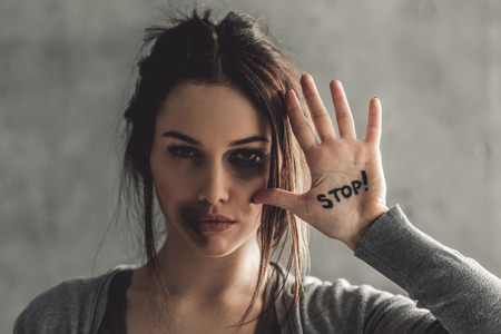 Girl being struck. Portrait of young girl with bruises on her face showing stop sign, on gray background