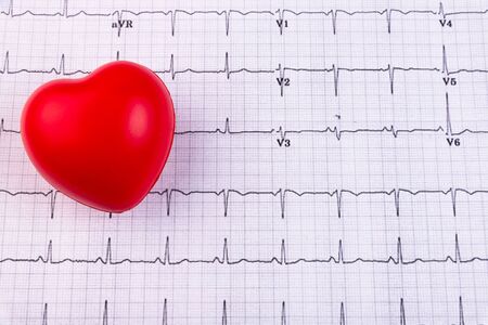 A red heart lying on cardiogram. Healthcare, cardiology and mediacal concept