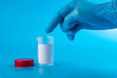 Doctor's hand in a blue medical glove points a finger at a container for urine analysis.