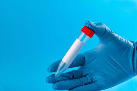 A medical workers hand in a sterile glove holds a clean blood test tube.