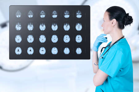 Doctor radiologist looks at the MRI, ultrasound, the child's brain in the CT scan room. Soft blurred background. medical poster. high quality photoの写真素材