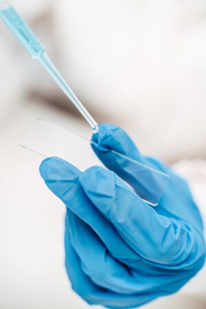 assistant in rubber gloves dripping liquid onto slide makes coronavirus test