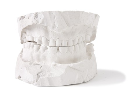 dental prosthesis