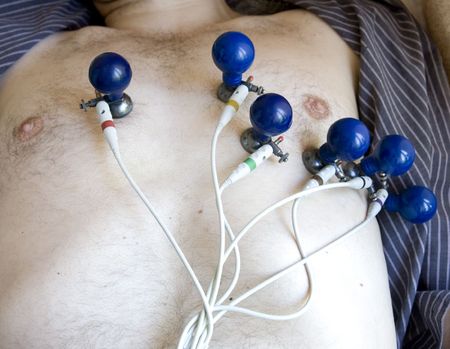 heart investigationの写真素材