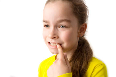 Little girl stands on a white background with a beautiful smile, children crooked teeth, pediatric dentistry. Crooked teeth close-up. Correction of malocclusion is required.の写真素材