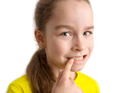 Little girl stands on a white background with a beautiful smile, children crooked teeth, pediatric dentistry. Crooked teeth close-up. Correction of malocclusion is required.の写真素材
