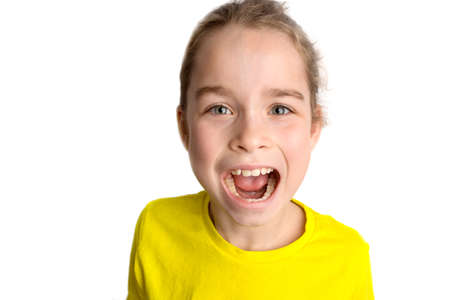 Little girl stands on a white background with a beautiful smile, children crooked teeth, pediatric dentistry. Crooked teeth close-up. Correction of malocclusion is required.の写真素材