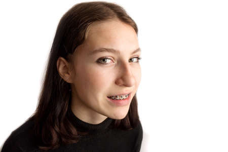 Orthodontic treatment. Dental care concept. Smiling teenage girl with braces. Metal braces close-up on the teeth.の写真素材