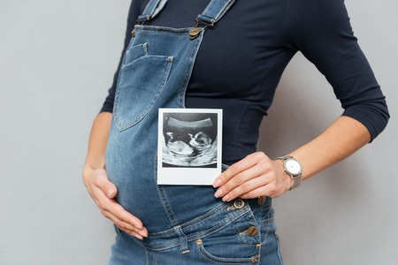 Cropped photo of pregnant woman standing and posing while showing ultrasound scans over grey background.の写真素材