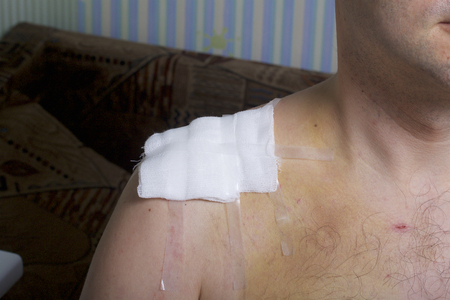 A man with a collarbone injury. The surgical suture is covered with a gauze swab and fixed with a plaster adhesive.の写真素材