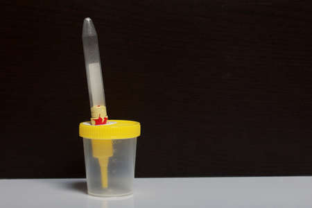 Disposable medical polymeric sterile container with a built-in holder for a vacuum test tube with a...