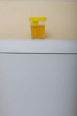 Urine in a container for analysis. Stands on the toilet cistern. Disposable medical polymeric sterile container with a built-in holder for a vacuum test tube with a screw cap.の写真素材