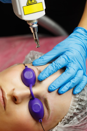 Laser removal of tattoo eyebrows. Shooting closeups. Cosmetic medical procedure in a beauty salon.の写真素材
