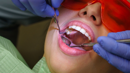 Dentist does routine inspection of teeth and gums. Girl patient in dental clinic. Close-up.の写真素材