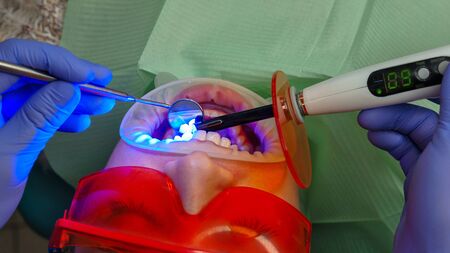 Dentist makes dental seal of girl patient. Dental treatment. Dental clinic. Health care.の写真素材