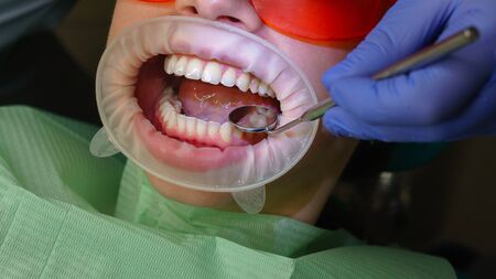 Dentist examines condition of teeth with help of dental mirror in patient's girl. Dental clinic....