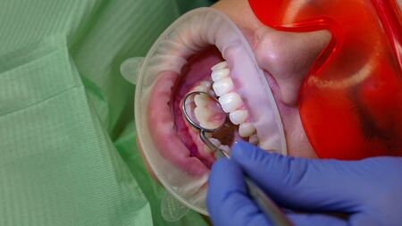 Dentist examines condition of teeth with help of dental mirror in patient's girl. Primary reception....