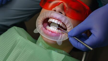 Dentist examines condition of back surface of teeth with help of dental mirror in girl patient. Primary reception. Dental clinic. Health care.の写真素材