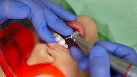 Dentist drill teeth woman patient. Close-up shot. Health care concept.の写真素材