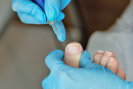 Hardware pedicure, preparation of the nail plate for applying gel polish. Master chiropody shapes the nails . Female patient in the process of hardware pedicure procedure. Foot careの写真素材