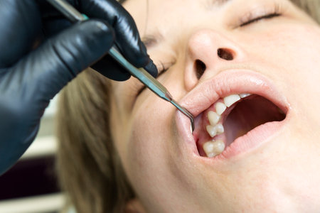 Dentist examining patient's teeth in dental clinic, closeup