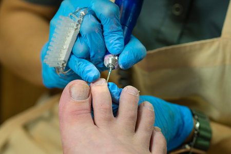 Process hardware pedicure. Nail artist with help of pedicure machine makes opening lateral sinuses. Customer's point of viewの写真素材