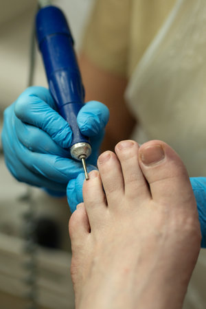 Podiatrist cleans toenail with electric drill during professional pedicure. Chiropody and podology concept, foot careの写真素材