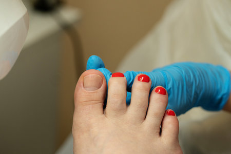 Freshly painted toenails inspected by podiatrist after polish application. Chiropody and podology concept, foot careの写真素材