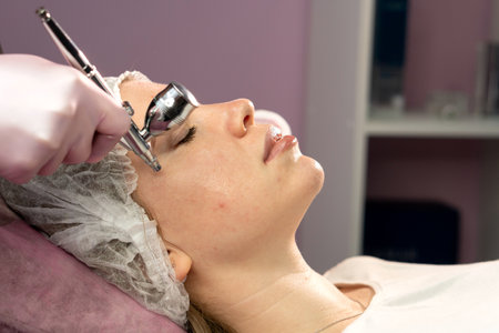 Esthetician applies microdermabrasion tool to the patient's cheek. Facial beauty treatment. Oxygen epidermal peeling. Girl enjoying skin rejuvenation therapy at cosmetology center. Jet peelの写真素材
