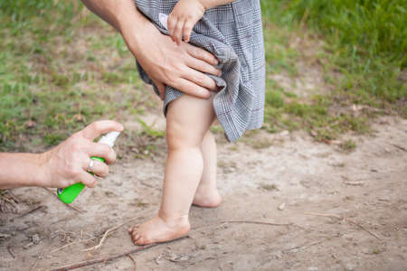 Dad treats his daughter with mosquito spray. The man uses spray on the child's arms and legs. Protection from mosquitoes in the forest. Spray from mosquitoes in nature and recreation.の写真素材