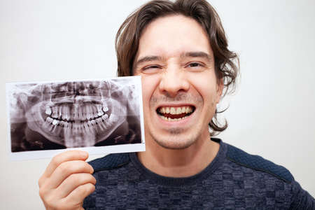 X-ray of teeth picture. The man smiles, opens his mouth. Poses, portrait. isolated